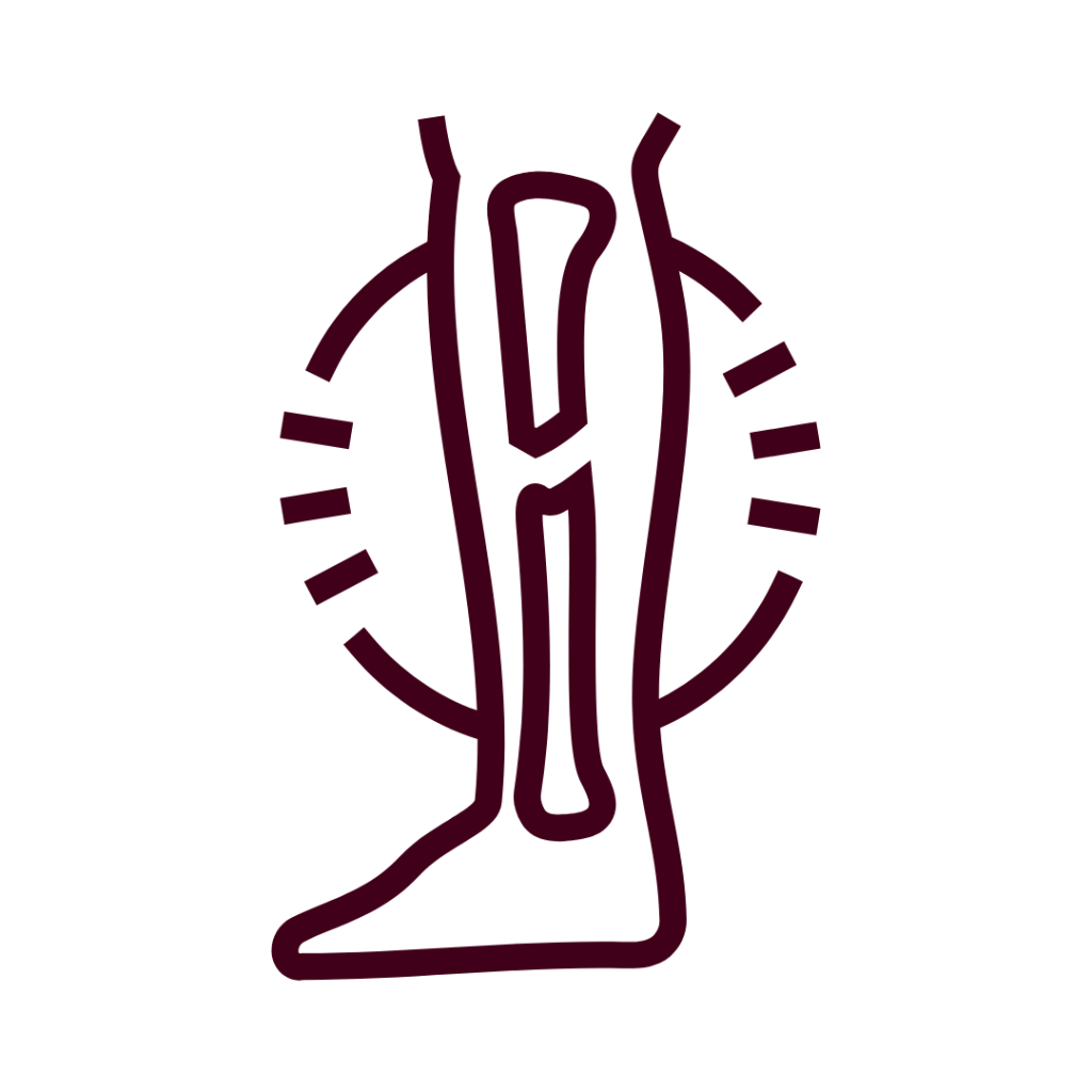 Bone Stress Injuries - Dr. Krish Rasaratnam